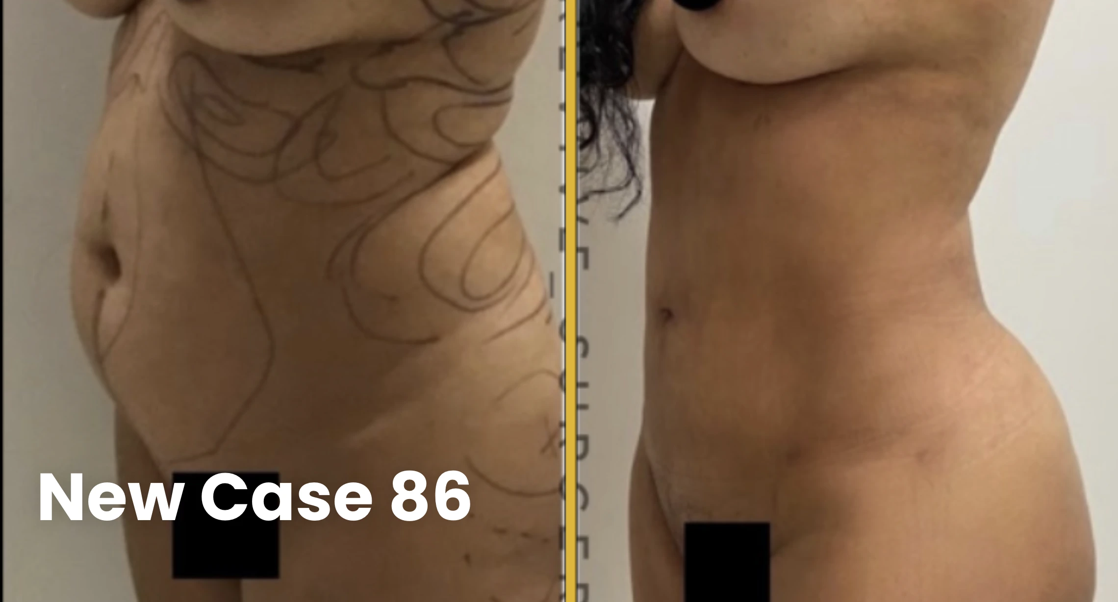 Screenshot 2025-03-17 at 10.51.51 AM